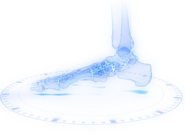 Flexible flatfoot reconstruction: the corrected alignment on the model