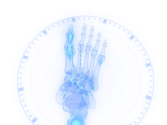Hallux valgus surgery: the corrected alignment on the model